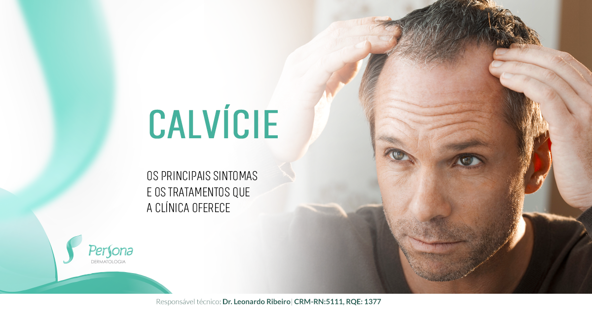 Calvície entenda melhor o problema que afeta homens e mulheres Calvície entenda melhor o problema que afeta homens e mulheres