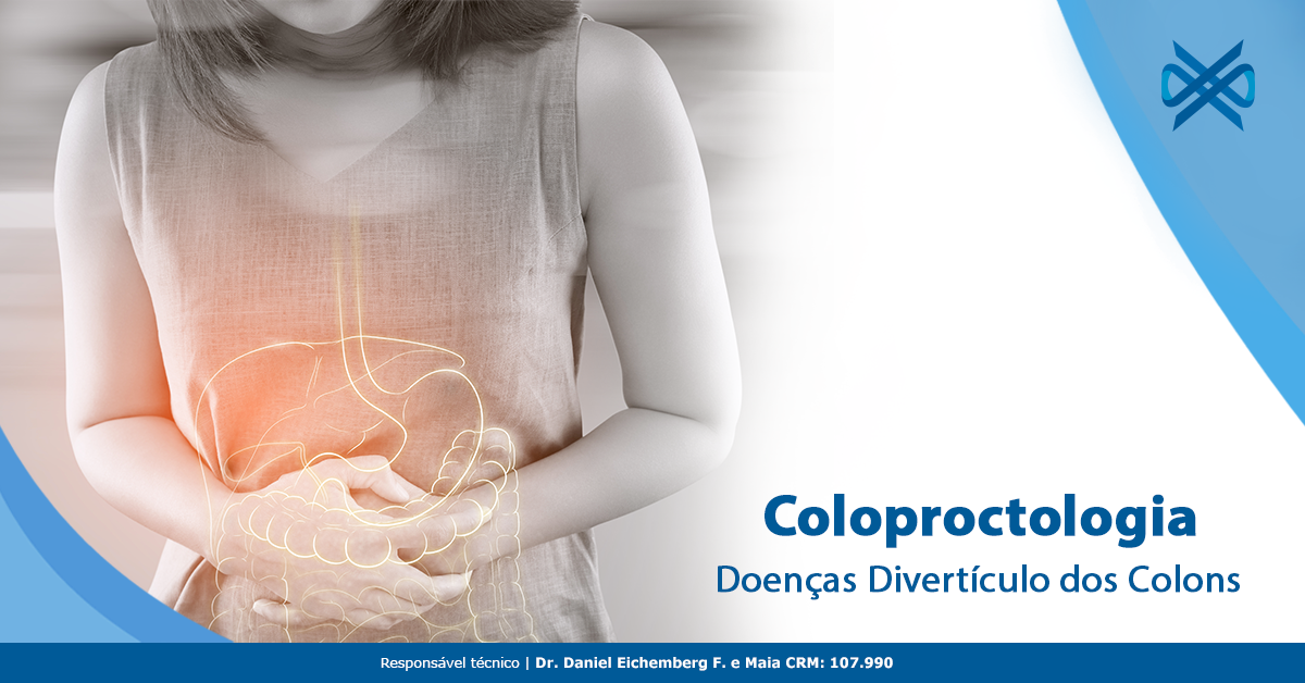 Coloproctologia Doenças Divertículo Dos Colons 3667